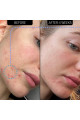 Blemish Clearing Moisturizer 2% Novoretin - Nemlendirici Gece Kremi 50 Ml Blemish Clearing Moisturizer 2% Novoretin - Nemlendirici Gece Kremi 50 Ml