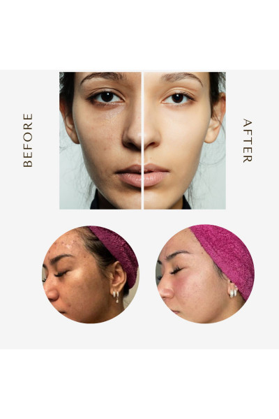 Derinlemesine Yüz Temizleyici Tonik Ped Turmeric Kojik Asit C Vitamini Cilt Serum Derinlemesine Yüz Temizleyici Tonik Ped Turmeric Kojik Asit C Vitamini Cilt Serum